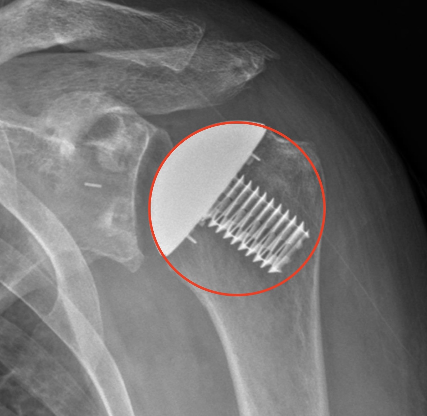 COR and the Iannotti circle